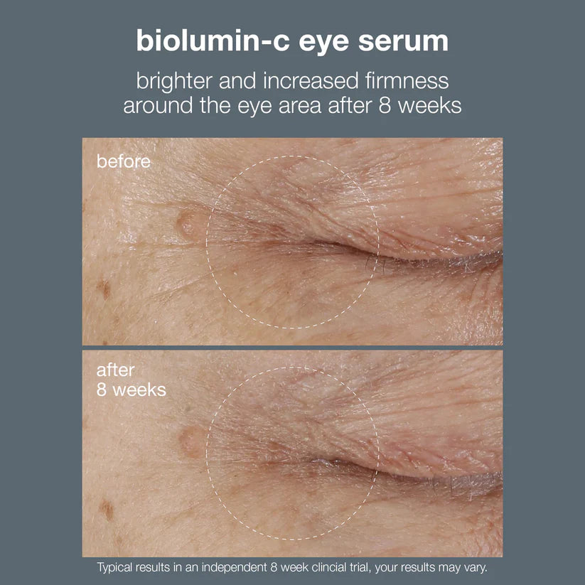 biolumin-c vitamin c eye serum